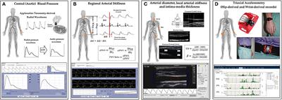 Influence of Epoch Length and Recording Site on the Relationship Between Tri-Axial Accelerometry-Derived Physical Activity Levels and Structural, Functional, and Hemodynamic Properties of Central and Peripheral Arteries